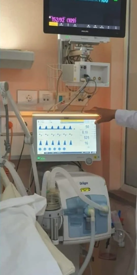 جامعة القاهرة تلعب دوراً حيوياً في تطوير أول جهاز تنفس صناعي مصري EZvent