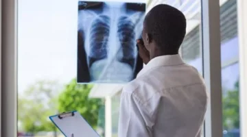 تحذيرات حسام موافي: معلومات حول السدة الرئوية وأعراضها
