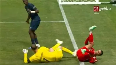 جمال موسيالا، نجم بايرن ميونخ، يتعرض لإصابة خطيرة خلال مواجهة باريس سان جيرمان في كأس العالم للأندية. جمال موسيالا، نجم بايرن ميونخ، يتعرض لإصابة خطيرة خلال مواجهة باريس سان جيرمان في كأس العالم للأندية.