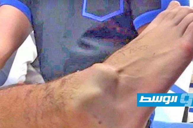 لحظة إسعاف جمال موسيالا لاعب فريق بايرن ميونخ الألماني خلال مواجهة فريقه مع باريس سان جيرمان في كأس العالم للأندية، السبت 5 يوليو 2025 (إكس)