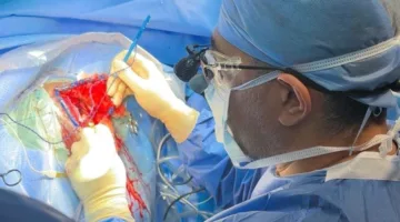 إنجاز تاريخي: نجاح أول عملية إزالة ورم دماغي في سلطنة عمان
