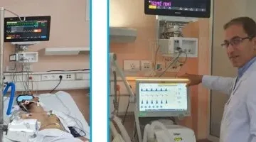 “معلومات الوزراء” تكشف عن أول جهاز تنفس صناعي مصري مصنع بالكامل محلياً