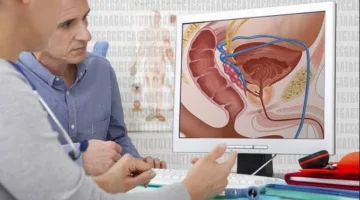 أستاذ من كلية طب القصر العيني: ليس كل تضخم في البروستاتا يدل على مشاكل صحية.. التفاصيل هنا