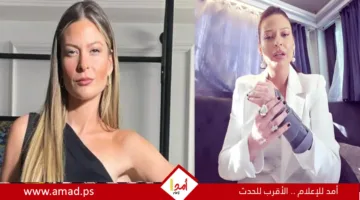 باميلا الكيك تحكي عن تجربتها بعد كسر ذراعها اليسرى.. فيديو