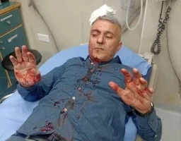 اعتداء على مراسل أردني من قِبل أربعة ملثمين مجهولين – صور
