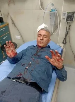 اعتداء على مراسل أردني من قِبل أربعة ملثمين مجهولين – صور اعتداء على مراسل أردني من قِبل أربعة ملثمين مجهولين – صور