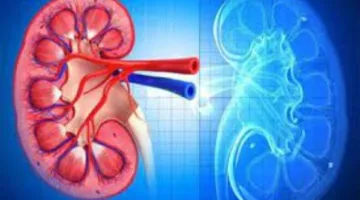 أعراض خاصة تشير إلى الإصابة بسرطان الكلى | اكتشفها الآن