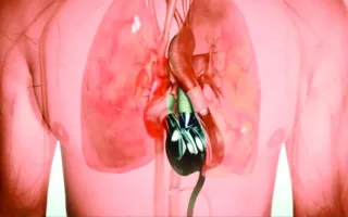 إنجاز طبيات: أول زراعة لمضخة قلب تعمل بنبض طبيعي