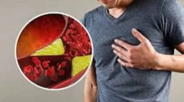 أطعمة تعمل على خفض مستويات الكوليسترول الضار للصغار والكبار