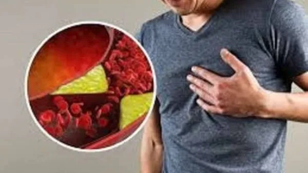 أطعمة تعمل على خفض مستويات الكوليسترول الضار للصغار والكبار