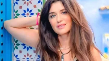 بعد تجربة غادة عادل مع عمليات شد الوجه… لمن تناسب هذه الجراحة؟