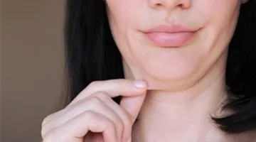 أهمها استخدام الهاتف: عوامل مفاجئة تسبب ظهور “اللغد”