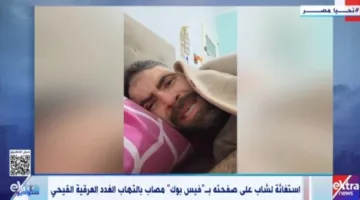 شاب يعاني من التهاب الغدد العرقية.. وزارة الصحة تتفاعل مع نداء استغاثته على فيس بوك