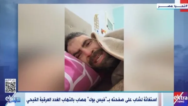 شاب يعاني من التهاب الغدد العرقية.. وزارة الصحة تتفاعل مع نداء استغاثته على فيس بوك