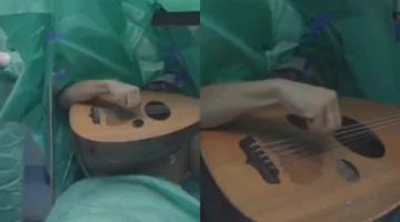 شاهد بالفيديو: مغني عراقي يعزف على العود خلال عملية إزالة ورم دماغي