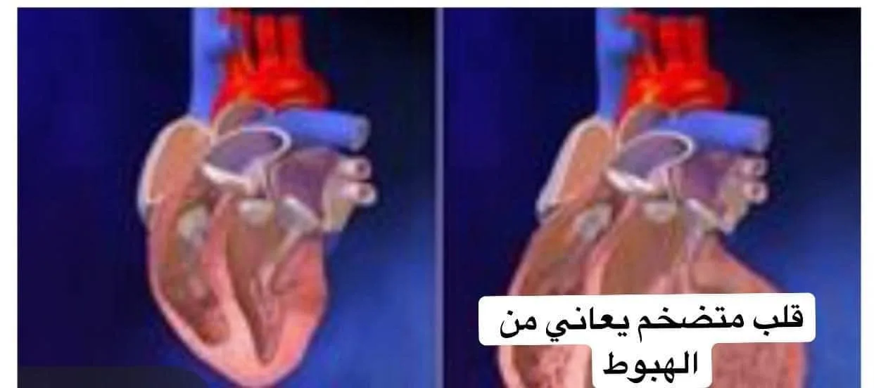 نشرة حول قضايا المرأة وأخبار متنوعة | عادة ليلية تزيد من خطر الأمراض القلبية.. أعشاب وتوابل تخفف الانتفاخ.. تحذيرات من النوم مع تشغيل المروحة في فصل الصيف