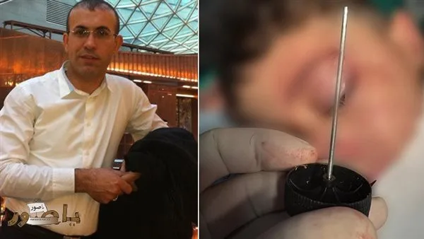 نجاح عملية نوعية للدكتور حسن جوني تُنقذ حياة طفل في مستشفى جبل عامل – صور