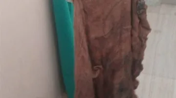تأييد حكم بالسجن لطبيب جراحة في قنا لعام واحد بعد نسيانه فوطة داخل بطن مريضة أدت وفاتها نتيجة الإهمال.