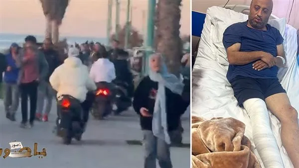“متهورو” الدراجات النارية على الأرصفة: ثلاثة شبان يسقطون ضحية إهمال قاصر يبلغ من العمر 15 عاماً في صور.