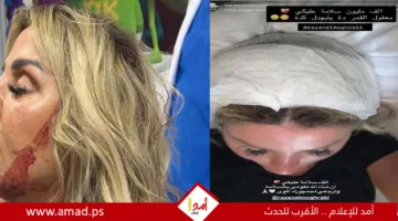 رزان مغربي ت reassures her fans following a head injury.