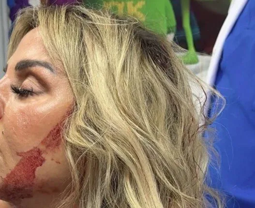 رزان مغربي تتصدر الترند بعد سقوط سقف القاعة فوقها «صورة» رزان مغربي تتصدر الترند بعد سقوط سقف القاعة فوقها «صورة»