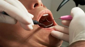 هل يؤثر فينير الأسنان على صحة الغسل أو الوضوء؟.. إجابة من دار الإفتاء