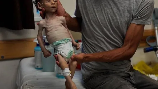شهداء نتيجة قصف الاحتلال في غزة.. والعديد يعانون من أزمة جوع تهدد حياتهم