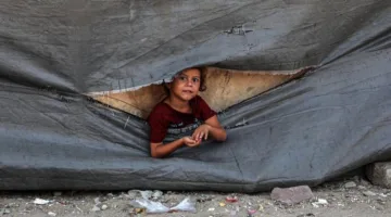 وزارة الصحة في غزة تُبلغ عن 18 حالة وفاة نتيجة الجوع خلال 24 ساعة