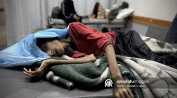 غزة تعاني من المجاعة.. وفاة فتاة بعد فقدان نصف وزنها