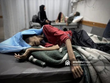 غزة تعاني من المجاعة.. وفاة فتاة بعد فقدان نصف وزنها غزة تعاني من المجاعة.. وفاة فتاة بعد فقدان نصف وزنها