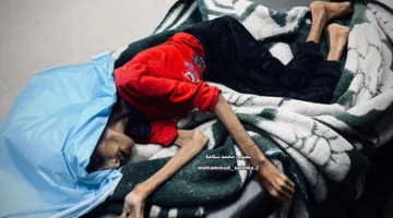 الجوع يفتك بالأرواح في غزة والعالم يتجاهل المشاهد المروعة