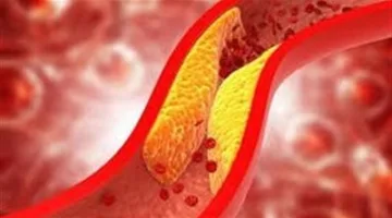 فواكه تحمي القلب من الكولسترول: 9 أنواع طبيعية بخصائص علاجية مذهلة