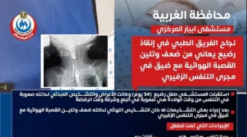 إنقاذ طفل حديث الولادة يعاني من ضعف وتلين في القصبة الهوائية بمستشفى أبيار في الغربية