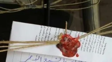 إغلاق مركز تجميل بعد حادثة تشويه لأحد العملاء!