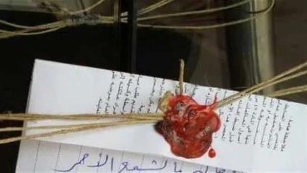 إغلاق مركز تجميل بعد حادثة تشويه لأحد العملاء! إغلاق مركز تجميل بعد حادثة تشويه لأحد العملاء!