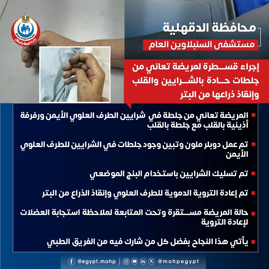 إنقاذ مريضة من عملية بتر ذراعها.. فريق مستشفى السنبلاوين يكتبون قصة بطولية جديدة إنقاذ مريضة من عملية بتر ذراعها.. فريق مستشفى السنبلاوين يكتبون قصة بطولية جديدة