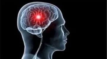 منتج منزلي معروف قد يؤدي إلى سكتة دماغية… ما هو السائل الذي يجب توخي الحذر منه؟