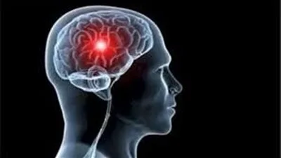 منتج منزلي معروف قد يؤدي إلى سكتة دماغية… ما هو السائل الذي يجب توخي الحذر منه؟ منتج منزلي معروف قد يؤدي إلى سكتة دماغية… ما هو السائل الذي يجب توخي الحذر منه؟