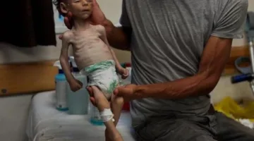 استشهاد 44 فلسطينيًا، منهم 16 بسبب الجوع، جراء غارات إسرائيلية وإطلاق نار في غزة.. و”الأونروا” تشير إلى أن المجاعة مدبرة ومتعمدة.