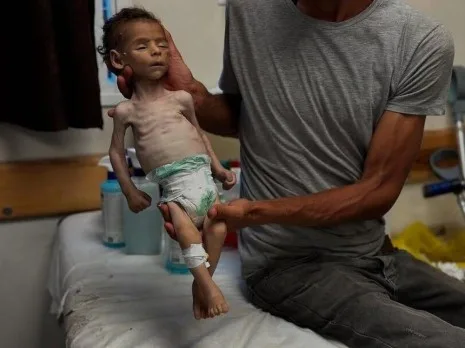استشهاد 44 فلسطينيًا، منهم 16 بسبب الجوع، جراء غارات إسرائيلية وإطلاق نار في غزة.. و”الأونروا” تشير إلى أن المجاعة مدبرة ومتعمدة.