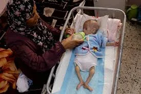 الطفلة زينب أبو حليب.. ضحية جديدة لجوع غزة