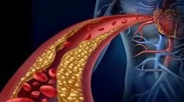 5 فواكه تحارب الكولسترول وتعزز صحة القلب