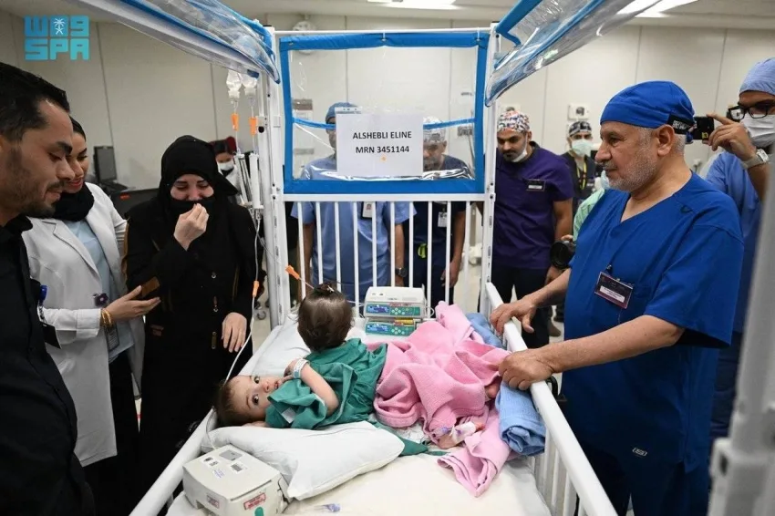 تنفيذًا لتعليمات القيادة.. بدء فصل التوأم السوري سيلين وإيلين تنفيذًا لتعليمات القيادة.. بدء فصل التوأم السوري سيلين وإيلين