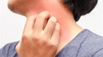 احترس من الحكة بعد الاستحمام.. فقد تكون علامة على مشكلة أكبر من جفاف الجلد.