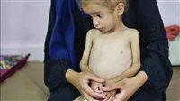 حكومة غزة: آلاف الرضع يواجهون خطر الوفاة بسبب حظر دخول حليب الأطفال من إسرائيل
