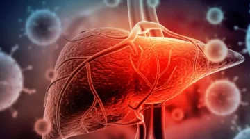 التهاب الكبد: الأسباب، الأعراض، العلاج وسبل الوقاية