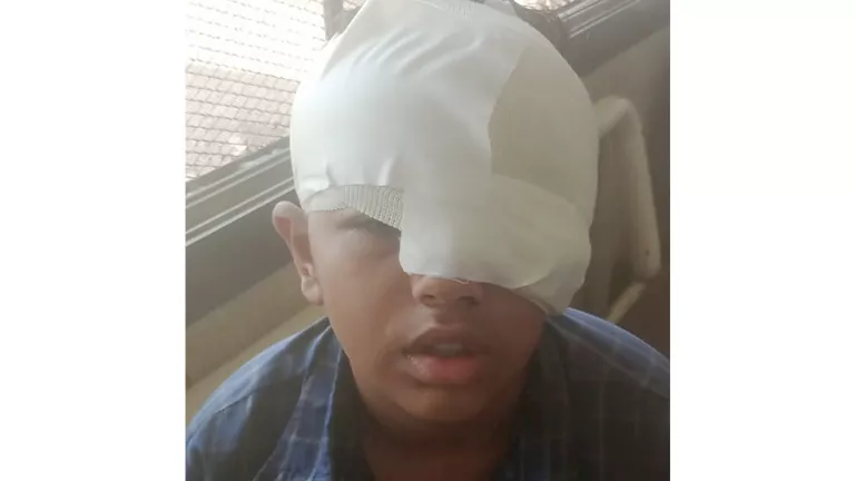 أنا ووجهي تضرر”.. قصة الطفل “معاذ” الذي تعرض للتنمر من زميله وأصيب في وجهه بـ”موس أنا ووجهي تضرر”.. قصة الطفل “معاذ” الذي تعرض للتنمر من زميله وأصيب في وجهه بـ”موس