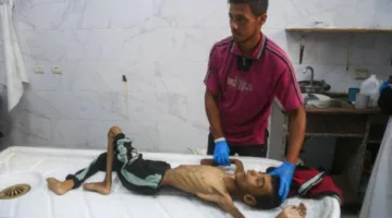 غزة المحاصرة.. عادل يُسجل وفاته بوزن 15 كيلوغراماً