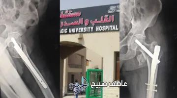مستشفى الصدر في المنيا ينفذ جراحة معقدة لإنقاذ رجل مسن يبلغ من العمر 110 سنوات.