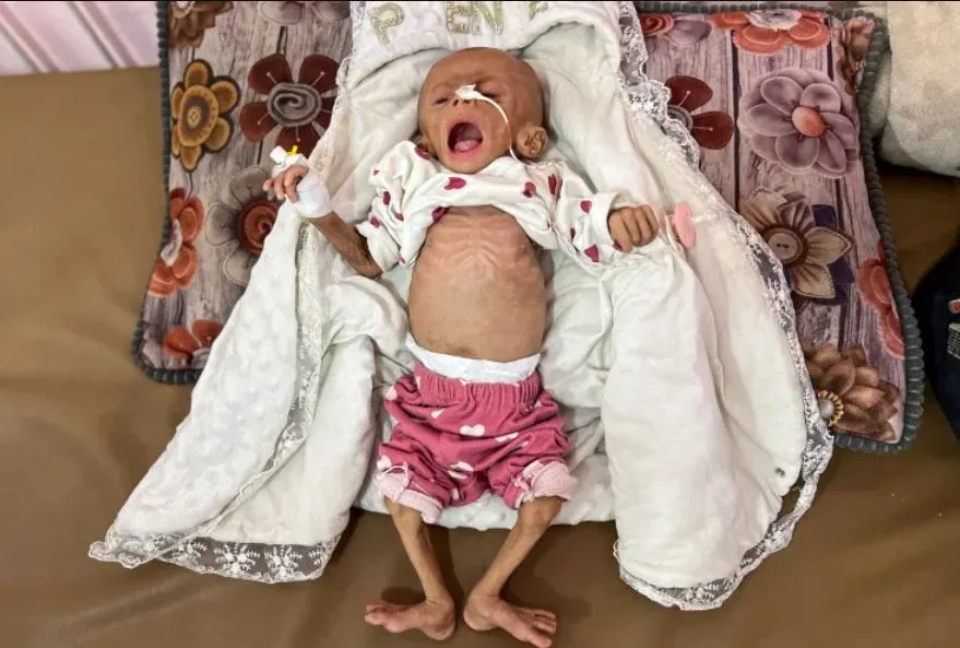 حالة وفاة ثانية خلال 24 ساعة: رضيع يموت جراء سوء التغذية والجوع في غزة حالة وفاة ثانية خلال 24 ساعة: رضيع يموت جراء سوء التغذية والجوع في غزة